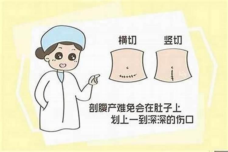 剖腹产怎么看星座