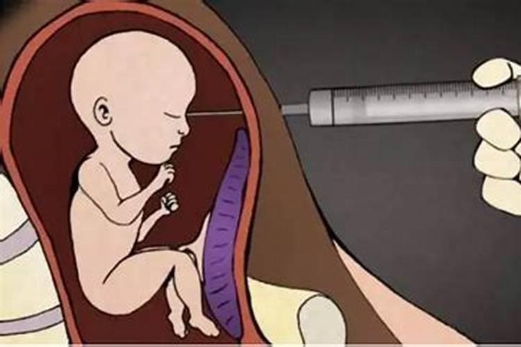 堕胎灵婴会从复几年来投胎吗
