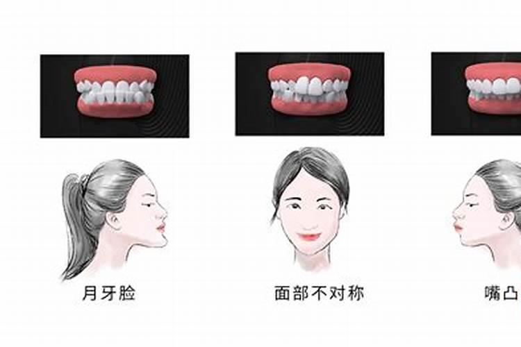 牙齿会影响人的运势吗