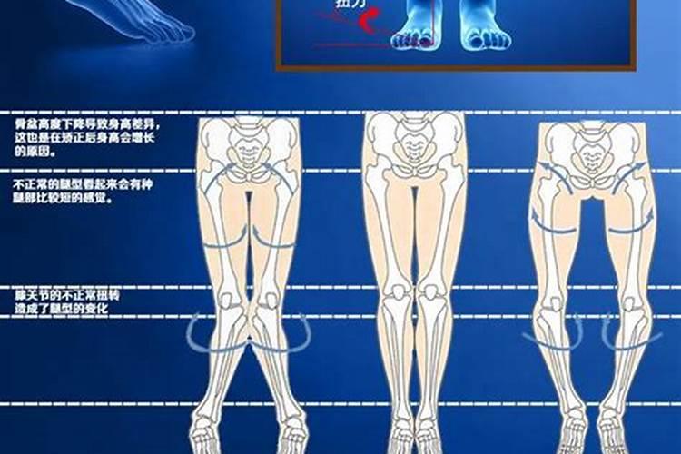 走路外八字会怎样