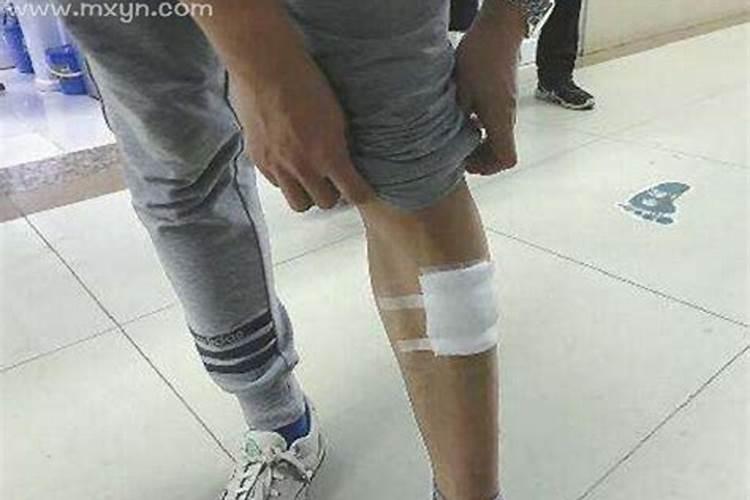 男人梦见狗咬腿是什么意思周公解梦