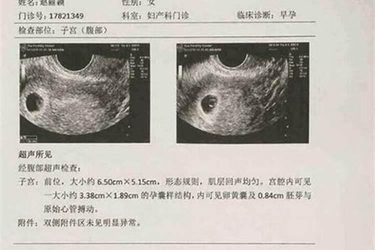 怀孕期间梦见大白蛇咬自己