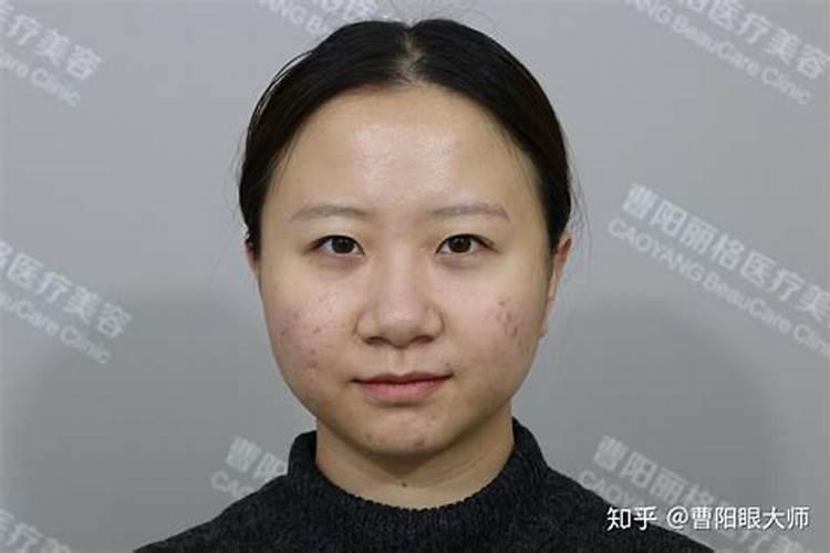 蒜头鼻女人什么命运